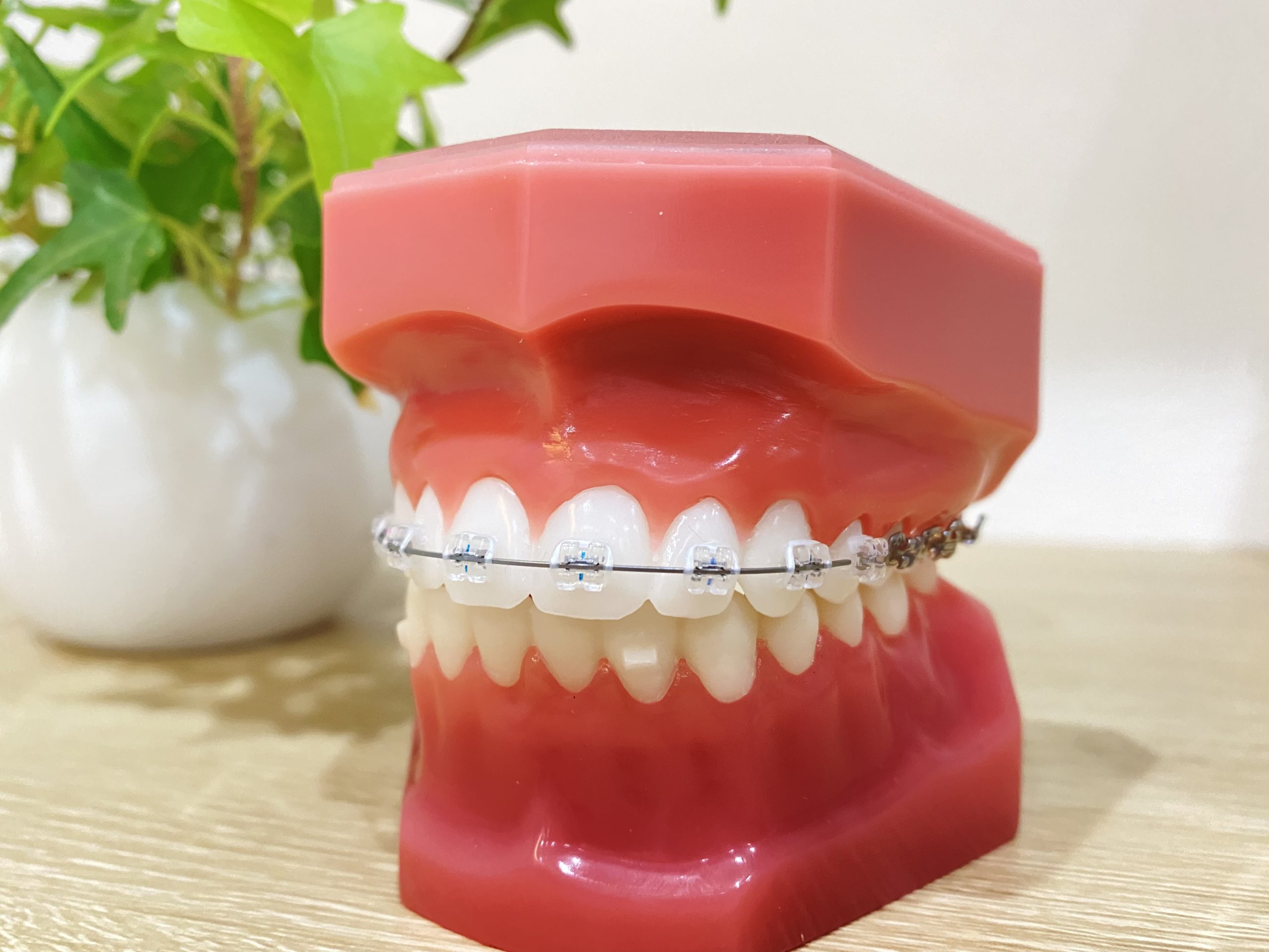 前歯の歯並びだけ気になる時、【部分矯正】で治せる？治せない？