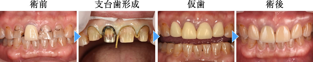 治療前後の比較