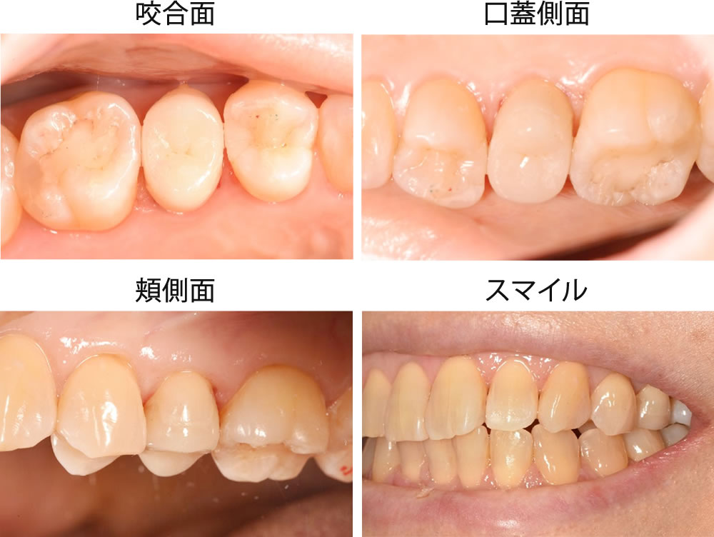 治療完了
