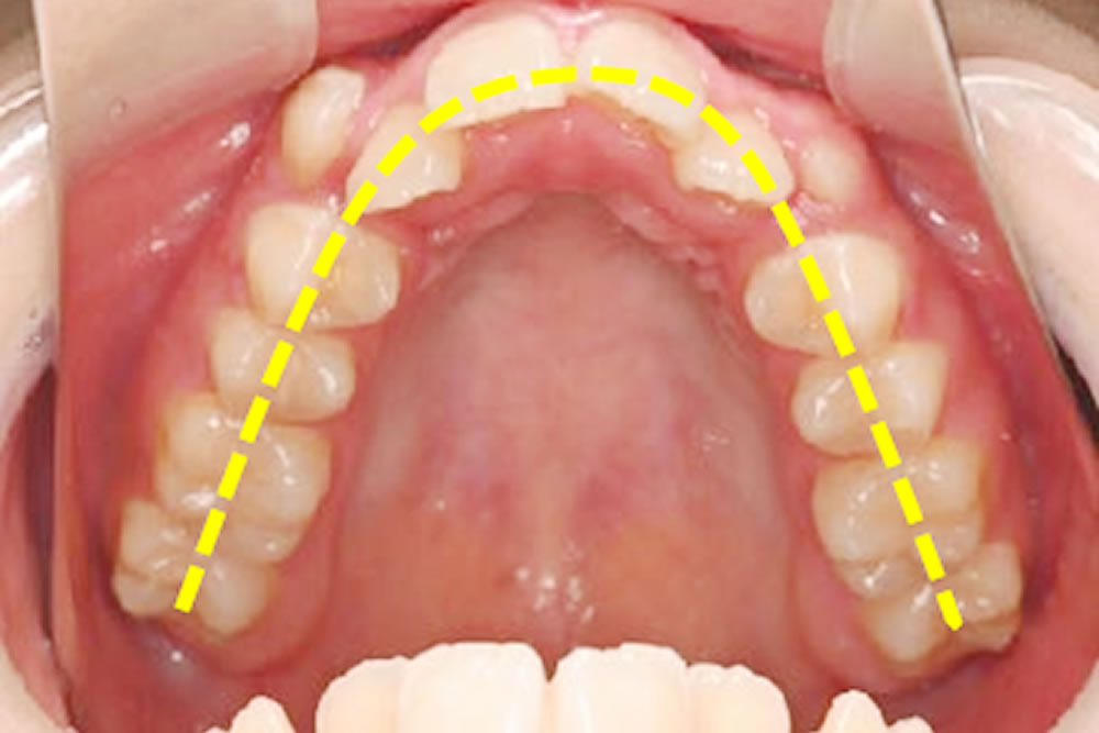 初診時の口腔内