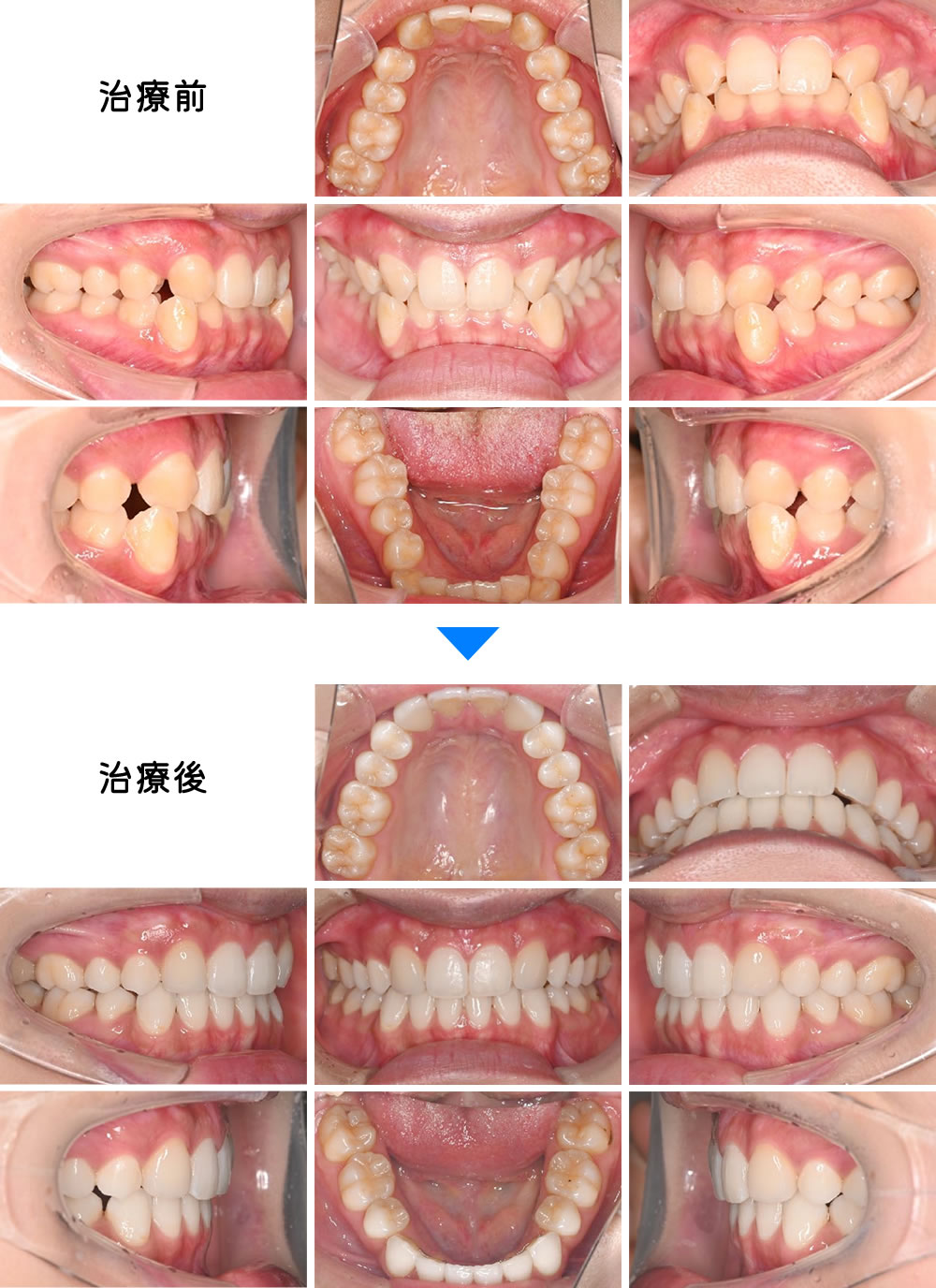 治療前後の比較