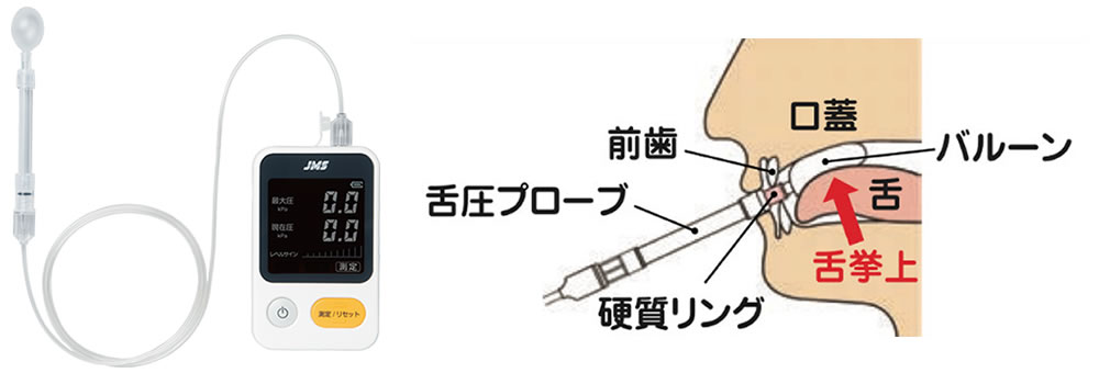 舌圧測定器(JMS)による数値評価