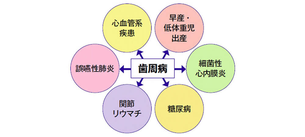 歯周病と糖尿病の関係　その１