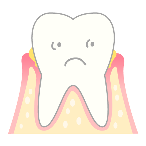 歯周病ってどんな病気なんだろう？