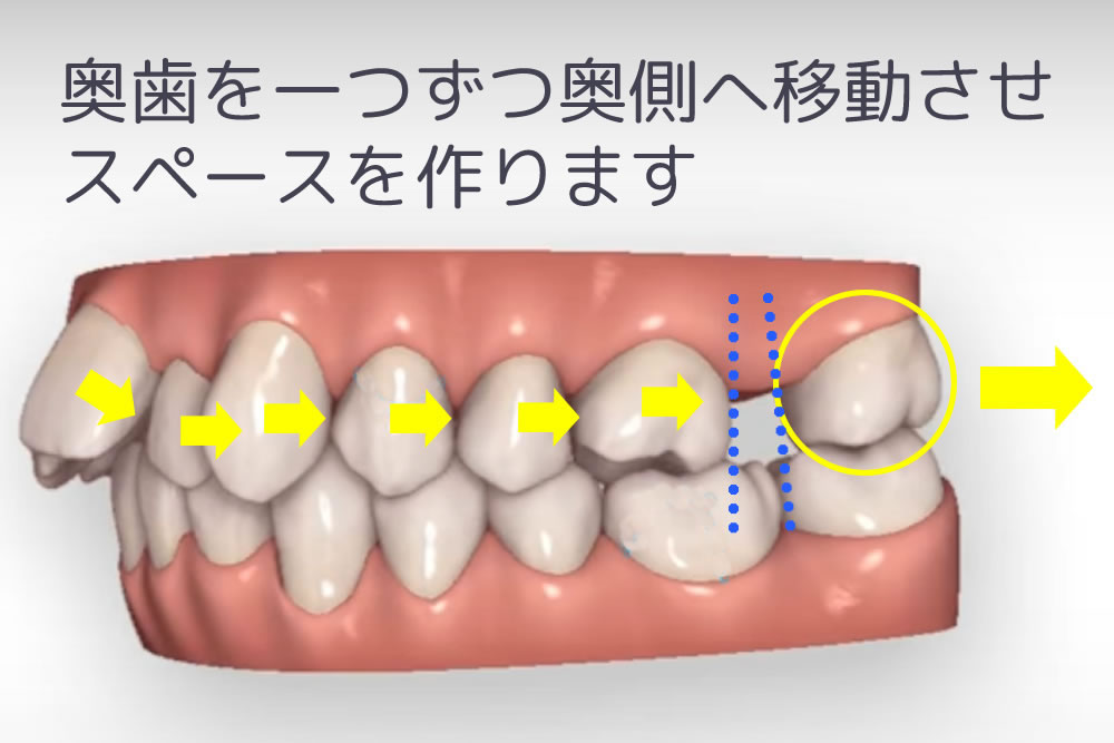 遠心移動装置